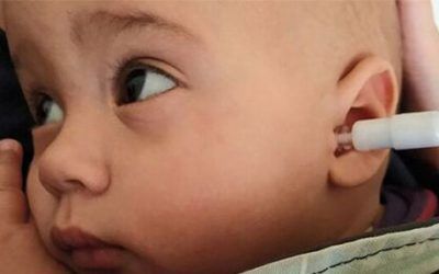 Cuando los niños rechazan sus audífonos